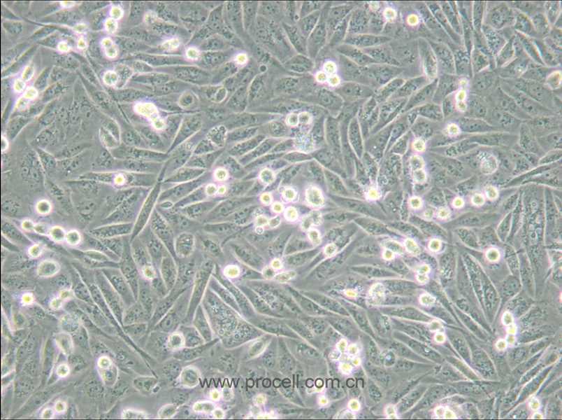 MDA-MB-231/GFP (人乳腺癌细胞(绿色荧光蛋白标记) (STR鉴定正确)