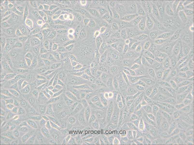 TPC-1 (人甲状腺癌细胞) (STR鉴定正确)