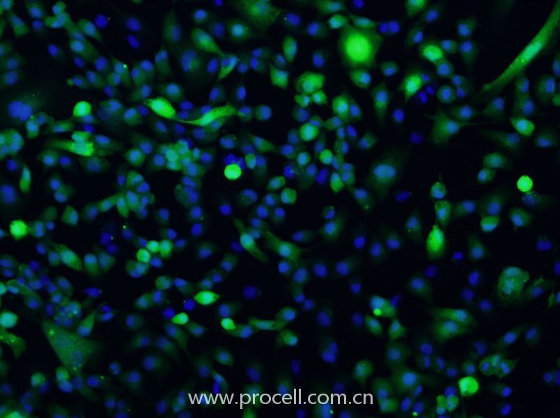 ACHN/GFP (人肾细胞腺癌细胞(绿色荧光标记)) (STR鉴定正确)