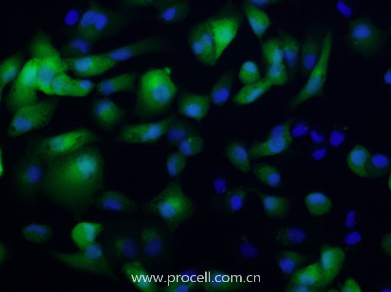 ACHN/GFP (人肾细胞腺癌细胞(绿色荧光标记)) (STR鉴定正确)