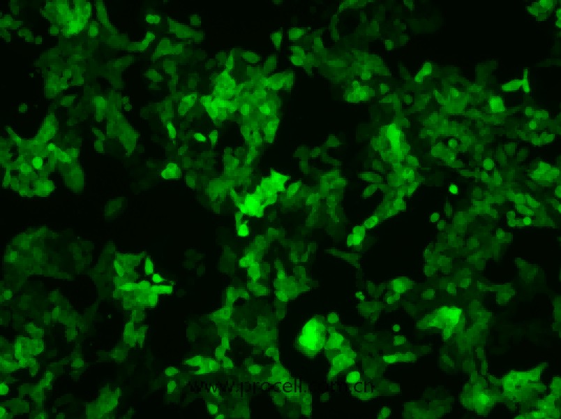 SW620/GFP (人结肠癌细胞(绿色荧光蛋白标记))  (STR鉴定正确) 