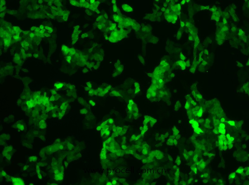 SW620/GFP (人结肠癌细胞(绿色荧光蛋白标记))  (STR鉴定正确) 