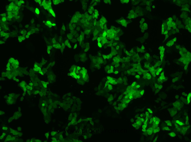 SW620/GFP (人结肠癌细胞(绿色荧光蛋白标记))  (STR鉴定正确) 