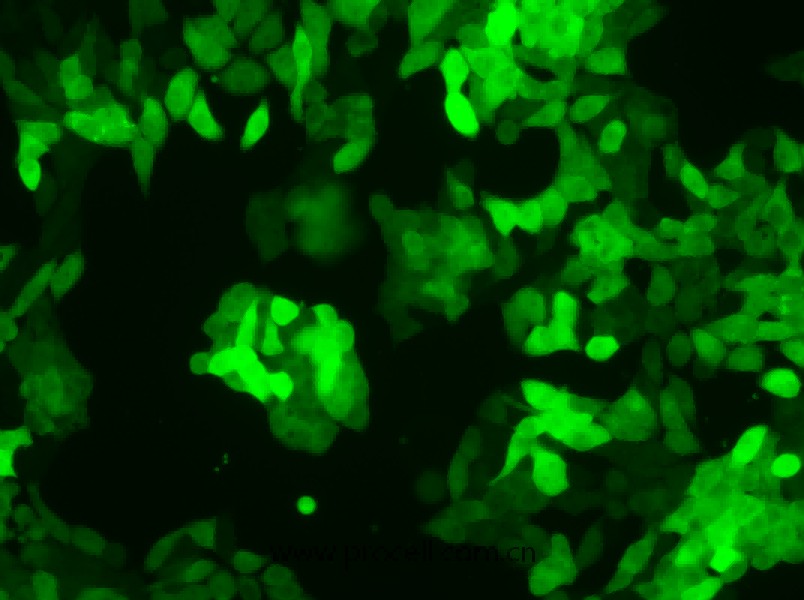 SW620/GFP (人结肠癌细胞(绿色荧光蛋白标记))  (STR鉴定正确) 