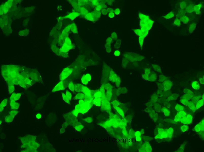 SW620/GFP (人结肠癌细胞(绿色荧光蛋白标记))  (STR鉴定正确) 