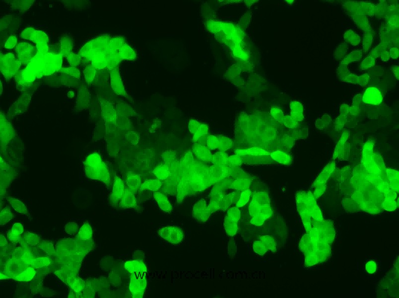 SW620/GFP (人结肠癌细胞(绿色荧光蛋白标记))  (STR鉴定正确) 
