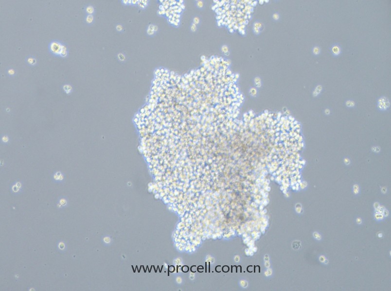 SHP-77（人小细胞肺癌细胞）（STR鉴定正确）