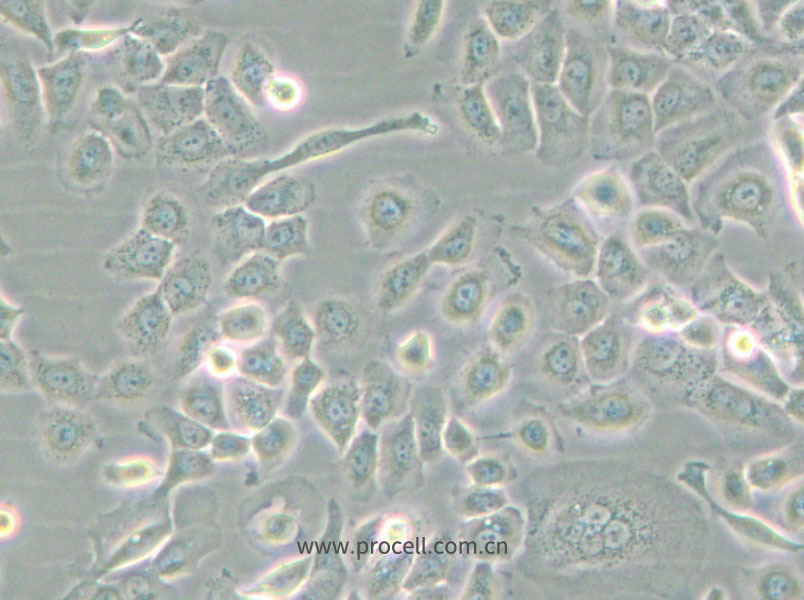 SUM149PT (人乳腺癌细胞) (STR鉴定正确)