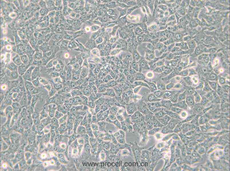 SN12C (人肾癌细胞) (STR鉴定正确)