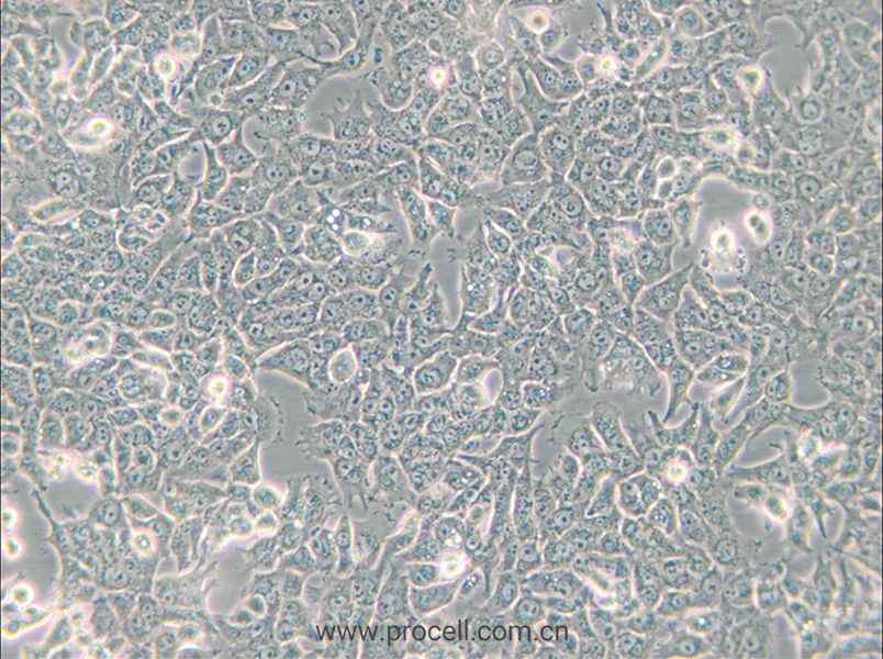 SN12C (人肾癌细胞) (STR鉴定正确)