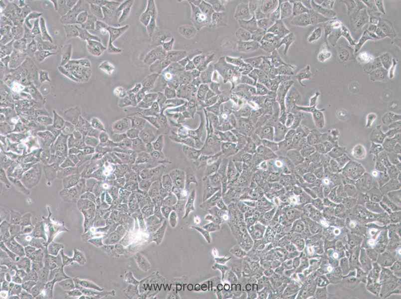 HCC4006 (人肺癌腺癌细胞) (STR鉴定正确)