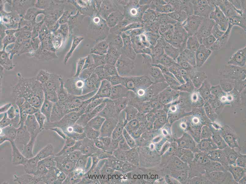 HCC4006 (人肺癌腺癌细胞) (STR鉴定正确)