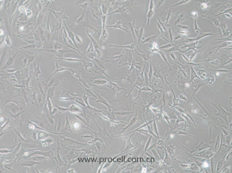 NCI-H1648 (人肺癌腺癌细胞) (STR鉴定正确)