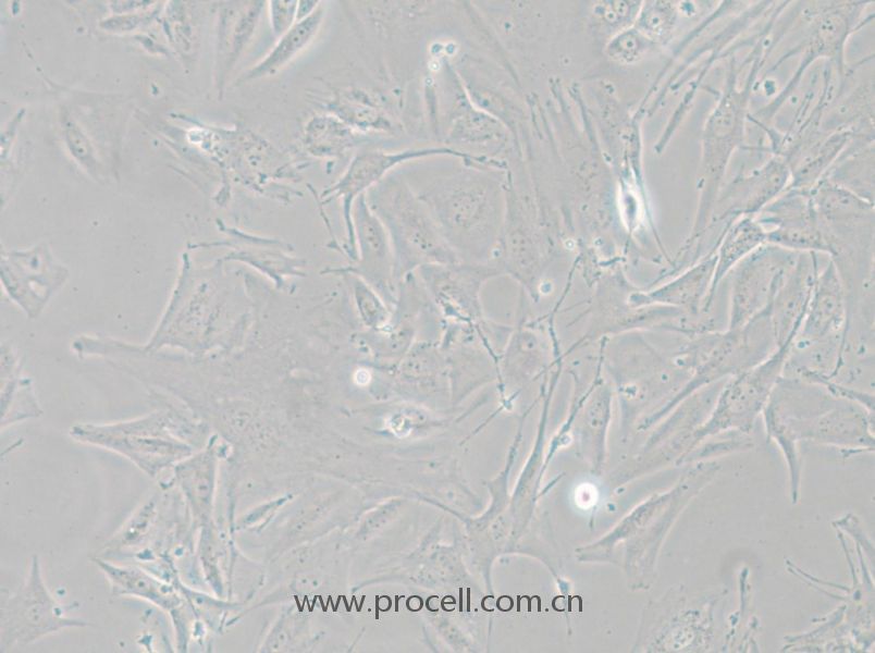 NCI-H1648 (人肺癌腺癌细胞) (STR鉴定正确)