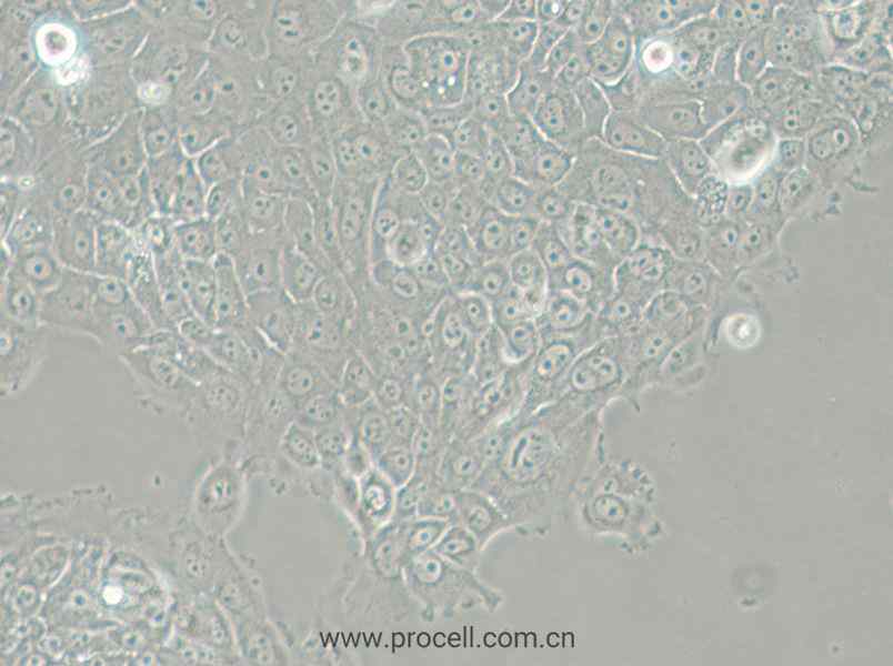 MCF-12A (人乳腺上皮细胞) (STR鉴定正确)