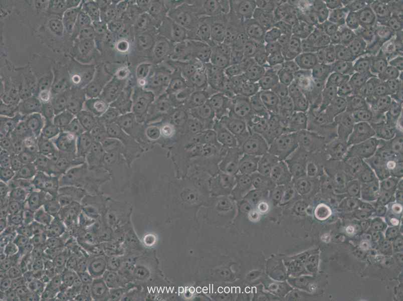 SACC-83 (人涎腺腺样囊性癌细胞) (STR鉴定正确)