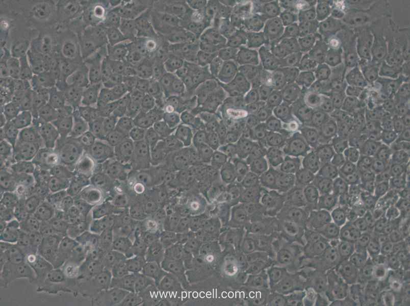 SACC-83 (人涎腺腺样囊性癌细胞) (STR鉴定正确)