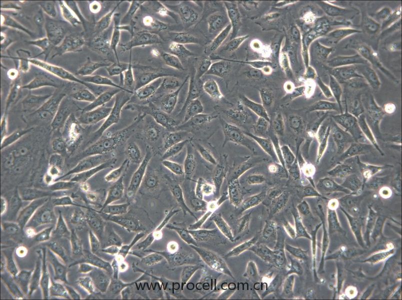HS-5 (人骨髓基质细胞) (STR鉴定正确)