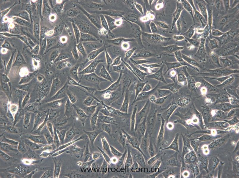 HS-5 (人骨髓基质细胞) (STR鉴定正确)