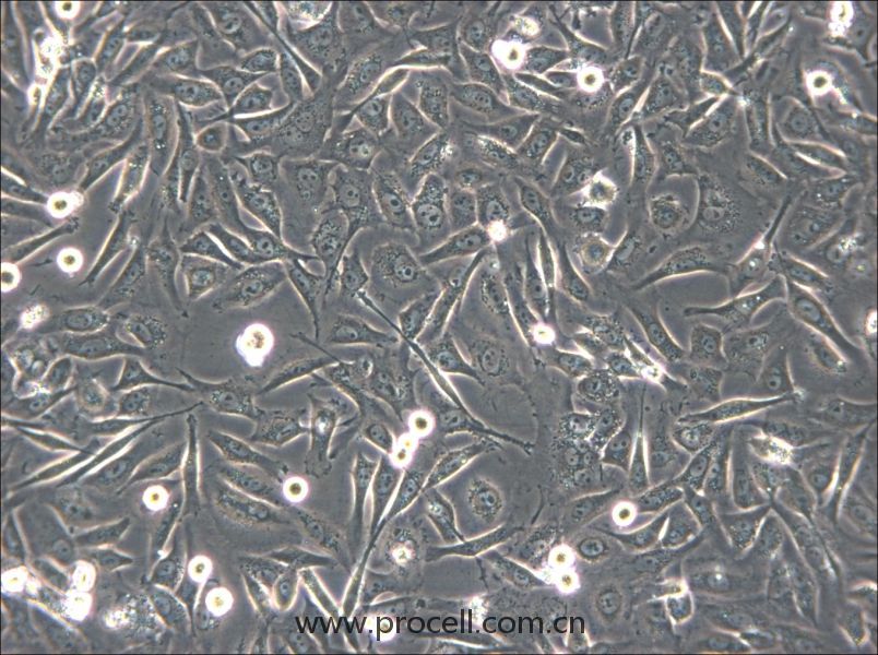HS-5 (人骨髓基质细胞) (STR鉴定正确)