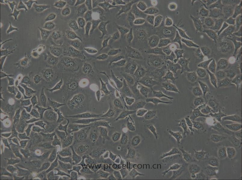 NP69SV40T (人鼻咽上皮细胞) (STR鉴定正确)