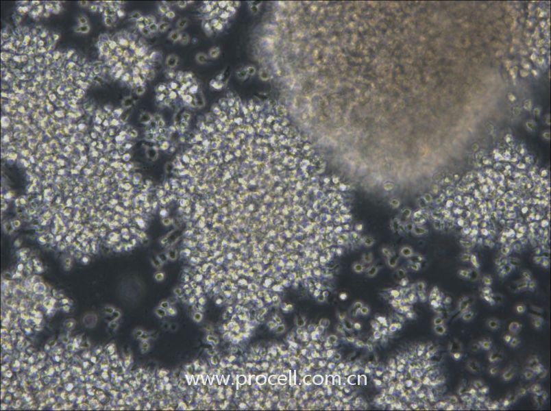 NCI-BL2009 (人淋巴母细胞（EBV 转化）) (STR鉴定正确)