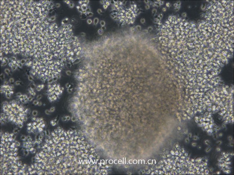 NCI-BL2009 (人淋巴母细胞（EBV 转化）) (STR鉴定正确)