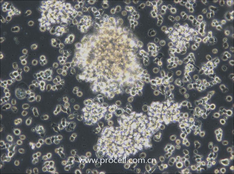 HCC38 BL (人淋巴母细胞（EBV 转化）) (STR鉴定正确)