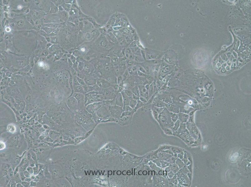 SU.86.86 (人胰腺导管癌细胞) (STR鉴定正确)