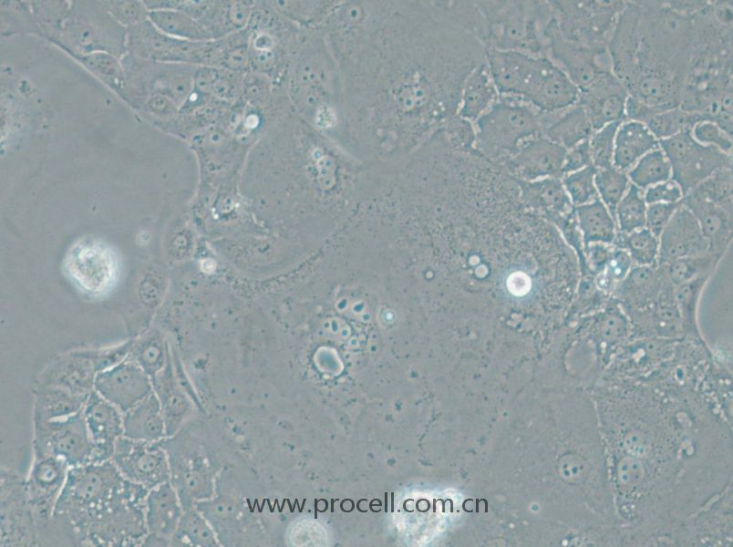 SU.86.86 (人胰腺导管癌细胞) (STR鉴定正确)