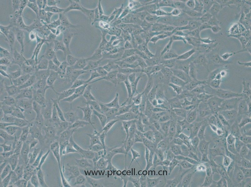 MPC-5 (小鼠肾足细胞) (STR鉴定正确)