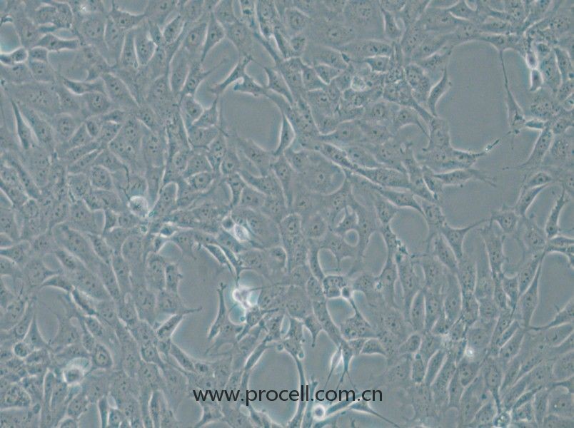 MPC-5 (小鼠肾足细胞) (STR鉴定正确)