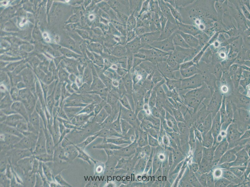 SW1271 (人小细胞肺癌细胞) (STR鉴定正确)