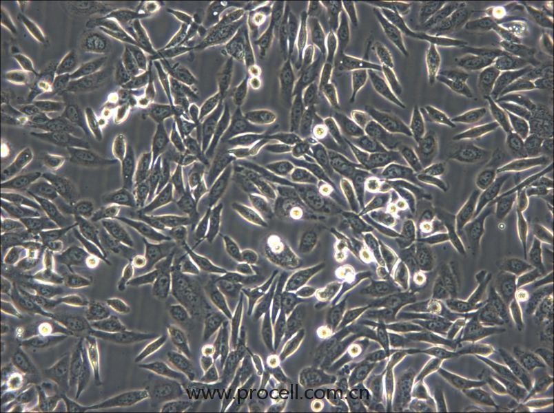 NUGC-3 (人胃癌细胞) (STR鉴定正确)