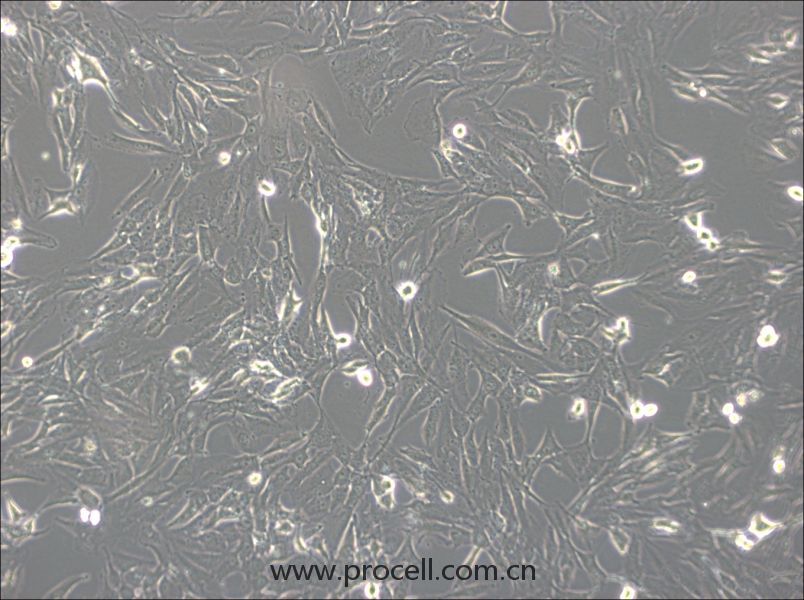 SW1783  (人脑星形胶质细胞瘤细胞) (STR鉴定正确)