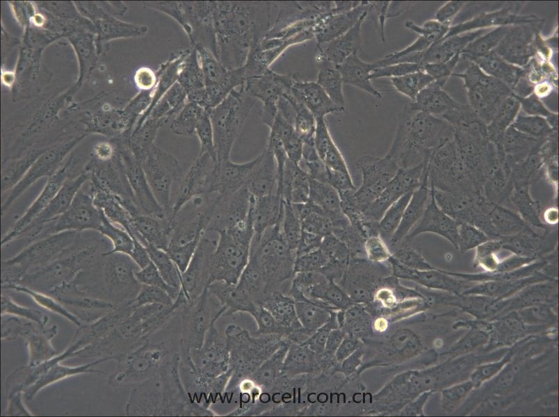 SW1783  (人脑星形胶质细胞瘤细胞) (STR鉴定正确)