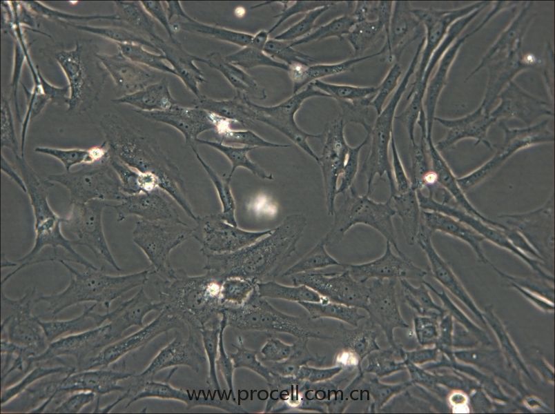 HS-27A (人骨髓细胞) (STR鉴定正确)