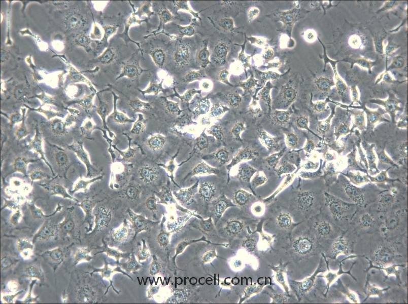 HCC1588(人肺鳞癌细胞) (STR鉴定正确)