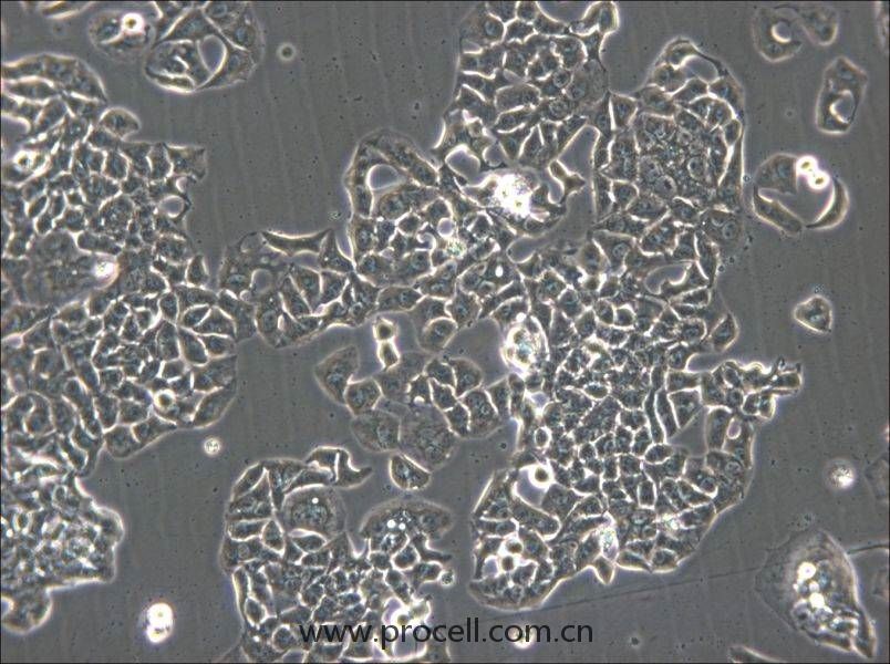 HCC1833 (人肺癌腺癌细胞) (STR鉴定正确)