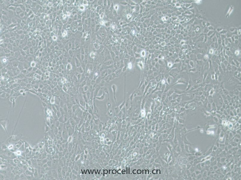 UM-SCC-1 (人口底鳞癌细胞) (STR鉴定正确)