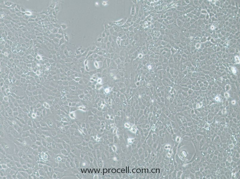 UM-SCC-1 (人口底鳞癌细胞) (STR鉴定正确)