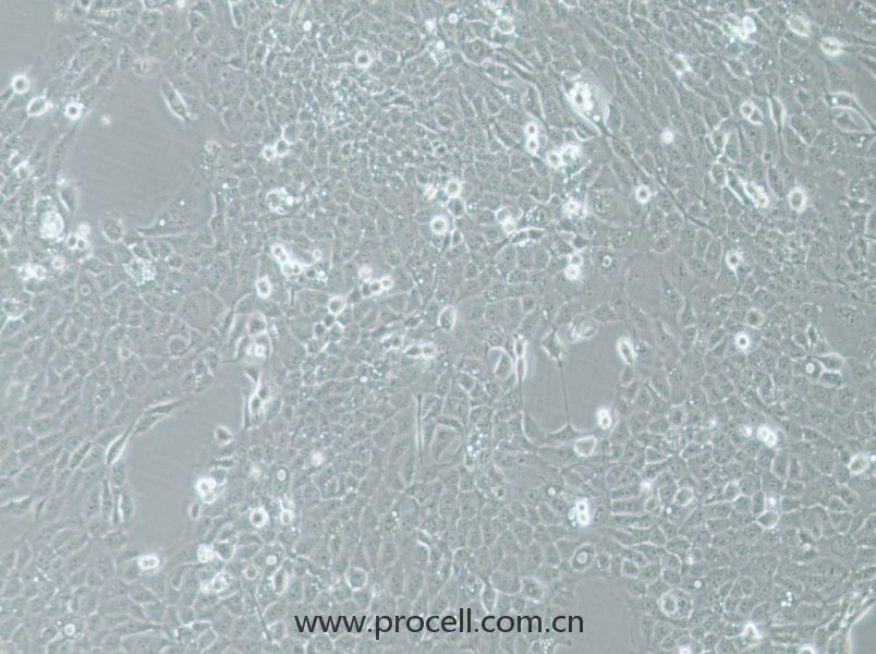 UM-SCC-1 (人口底鳞癌细胞) (STR鉴定正确)