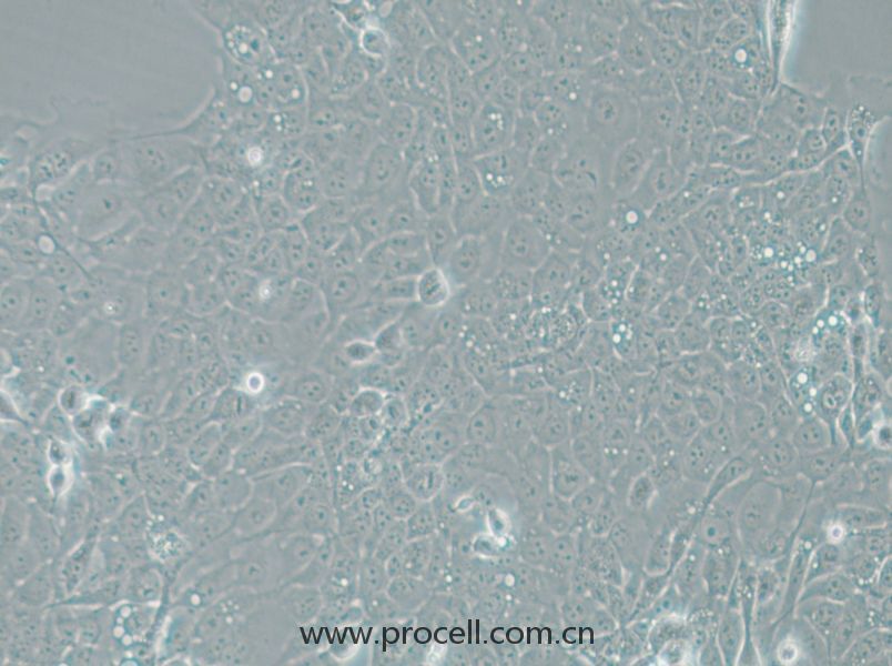 UM-SCC-1 (人口底鳞癌细胞) (STR鉴定正确)