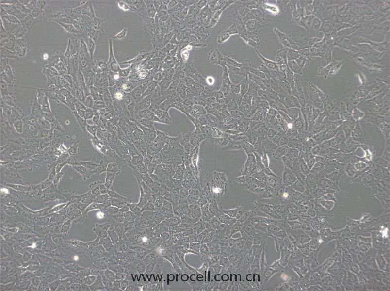 NCI-H1792(人肺腺癌细胞) (STR鉴定正确)