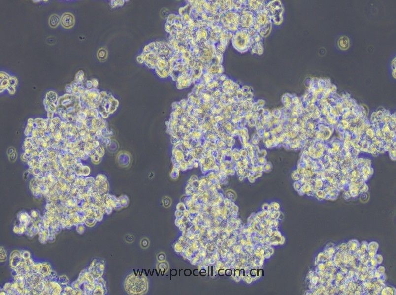 NCI-H187(人小细胞肺癌细胞) (STR鉴定正确)