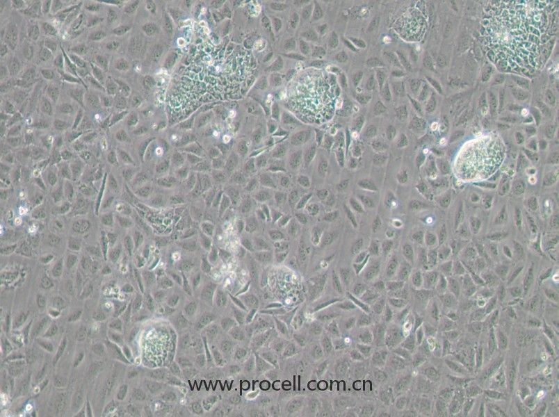 TR-LCC-1 (人喉癌细胞) (STR鉴定正确)