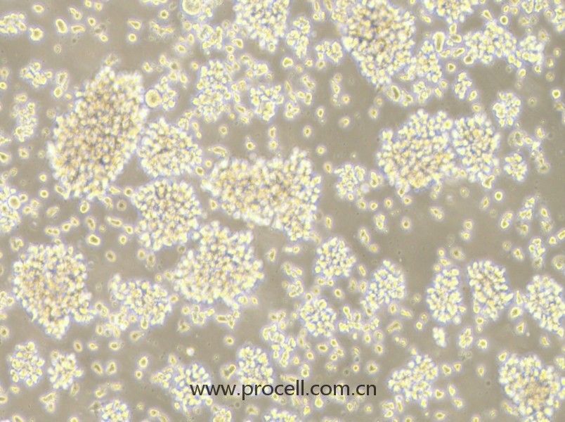 LCL 721.221 (人B淋巴细胞母细胞) (STR鉴定正确)