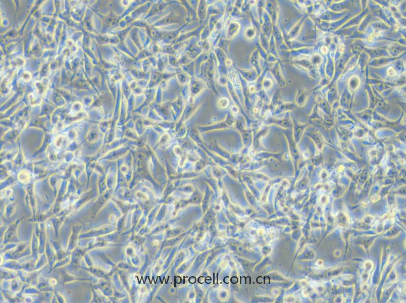 EBC-1 (人肺癌鳞癌细胞) (STR鉴定正确)