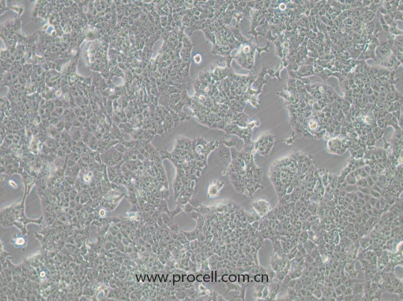 HePa1-6-GFP (小鼠肝癌细胞（绿色荧光标记）) (STR鉴定正确)