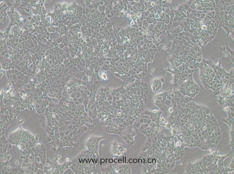 HePa1-6-GFP (小鼠肝癌细胞（绿色荧光标记）) (STR鉴定正确)